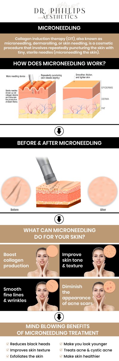 Microneedling is a highly effective treatment for reducing the appearance of certain acne scars by stimulating the skin's natural collagen and elastin production. The procedure utilizes fine needles to create controlled micro-injuries, which encourage cellular turnover and gradually smooth out depressed or pitted textures. Because scar types and skin sensitivities vary greatly, it is essential to consult Dr. Phillips Nagsuk, MD, to ensure this treatment is safe and tailored to your specific needs. For more information, contact us or book an appointment online. We are conveniently located at 242 N Edinburgh Drive Winter Park, FL, 32792.