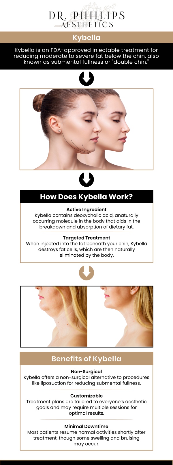 Kybella is a non-invasive option to permanently remove the unwanted fat that causes a double chin. Kybella is a prescription drug used to enhance the appearance and profile of mild to severe fat beneath the chin (submental fat), popularly known as a "double chin" in adults. Visit us for Kybella treatment for a double chin at Dr. Phillips Aesthetics. For more information, contact us or schedule an appointment online. We are conveniently located at 242 N Edinburgh Drive Winter Park, FL, 32792.