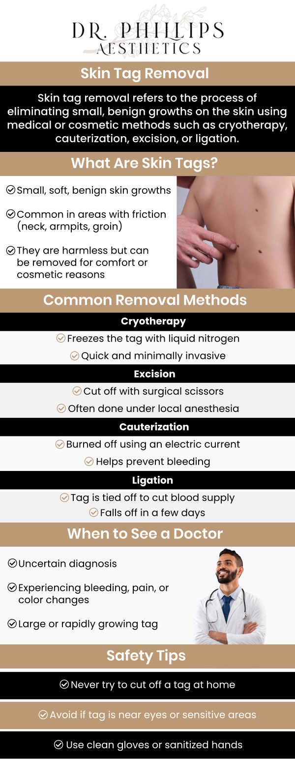 Skin tag removal is important for those dealing with benign growths that may cause discomfort or aesthetic concerns. These soft growths often appear on areas like the neck, underarms, and eyelids. While generally harmless, removal can enhance skin appearance and prevent issues such as infections or snagging. Consult Dr. Phillips Nagsuk, MD, for safe and effective removal tailored to your skin type, ensuring proper procedure and optimal healing. Contact us for more information or schedule your appointment now. We’re conveniently located at 242 N Edinburgh Drive, Winter Park, FL 32792. Skin tag removal is important for those dealing with benign growths that may cause discomfort or aesthetic concerns. These soft growths often appear on areas like the neck, underarms, and eyelids. While generally harmless, removal can enhance skin appearance and prevent issues such as infections or snagging. Consult Dr. Phillips Nagsuk, MD, for safe and effective removal tailored to your skin type, ensuring proper procedure and optimal healing. Contact us for more information or schedule your appointment now. We’re conveniently located at 242 N Edinburgh Drive, Winter Park, FL 32792.