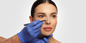 Botox for Bunny Lines in Winter Park, FL